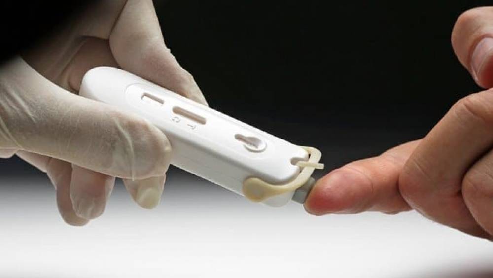 coronavirus la startup bretonne ng biotech va commercialiser un test ultra tapide