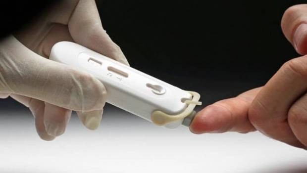 coronavirus la startup bretonne ng biotech va commercialiser un test ultra tapide