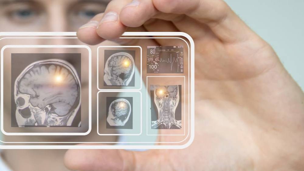 sante medecine medtech startup panacee